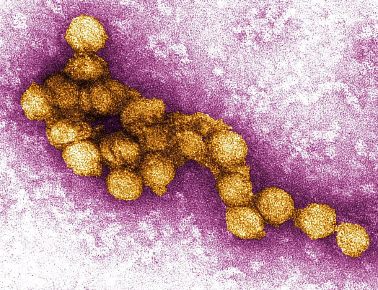 Länsi-Niilin virus: oireet ja hoito