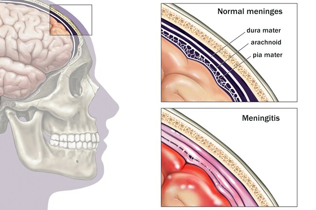 http://terveytta.net/wp-content/uploads/2020/12/1800ss_medicalimages_rm_brain_meninges_illustration.jpg