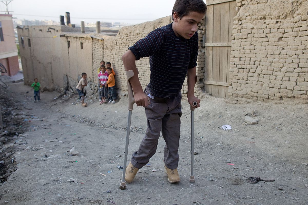 Polio: syyt, oireet ja hoito