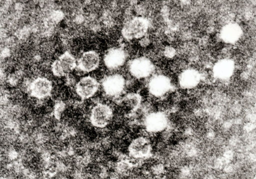 Parvovirus veressä.jpg