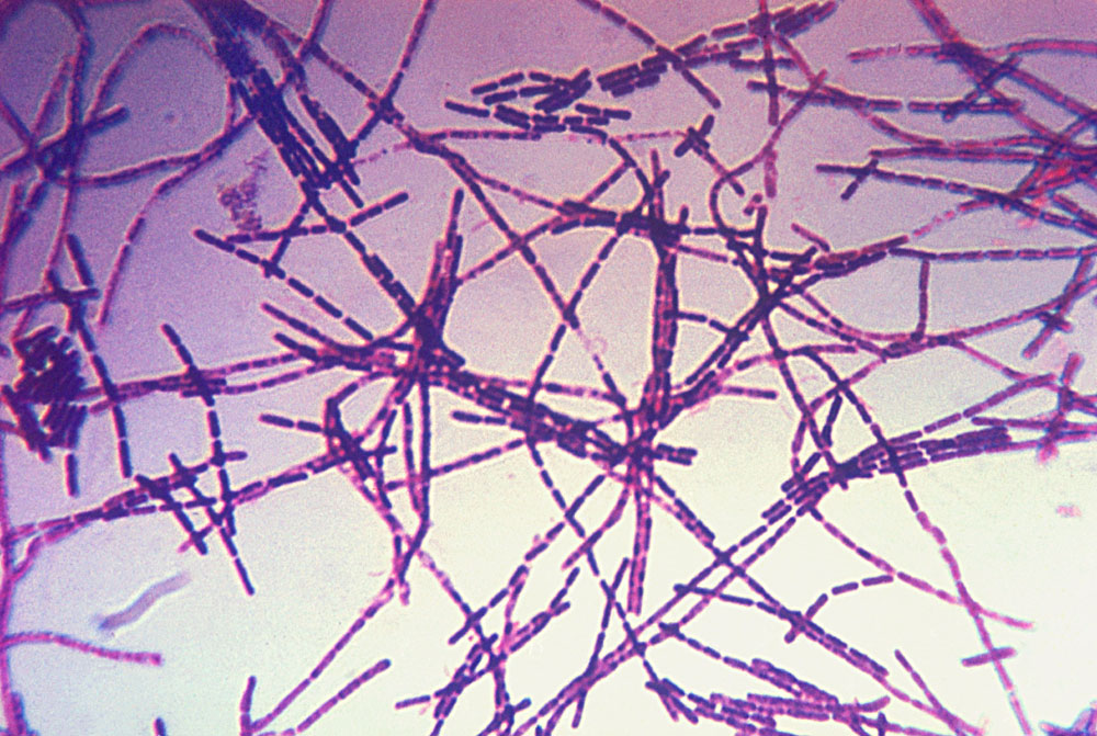 Bacillus anthracis -bakteeri