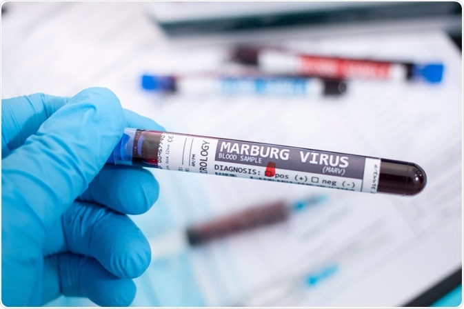 Marburg-virus